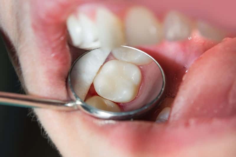 Jaką rolę odgrywa formówka stomatologiczna w pracy dentysty?